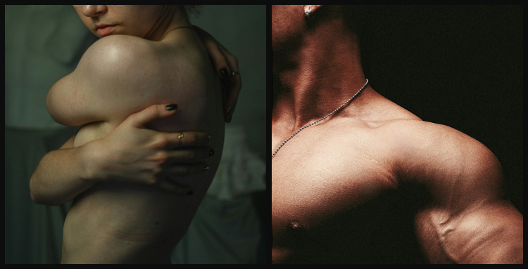 Spiseforstyrrelser i evolusjonært perspektiv